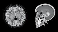 ct versus cone beam