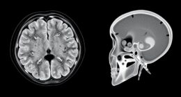 ct versus cone beam