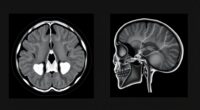 temporal bone imaging comparison