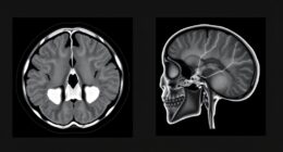 temporal bone imaging comparison