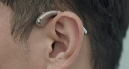 hearing aid feedback causes