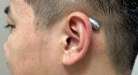 post surgery cochlear implant procedures