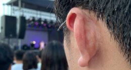 quiet after loud noise