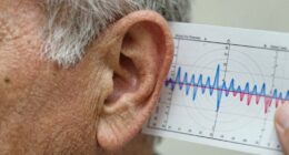 proving delayed hearing loss