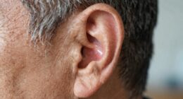 hearing loss indicates other conditions